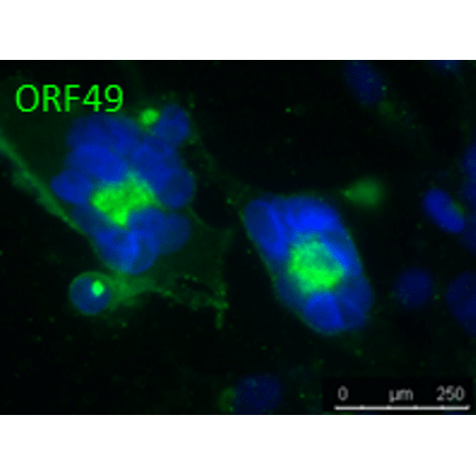 ORF49 (VZV) antibody
