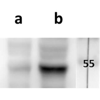 ORF5 (VZV) antibody