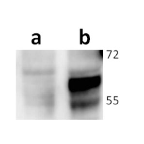 ORF67 (VZV) antibody