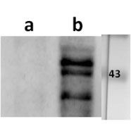 ORF9 (VZV) antibody