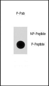 p21Cip1 (phospho-Ser130) antibody