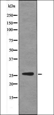 p27 Kip1 (Phospho-Ser178) antibody