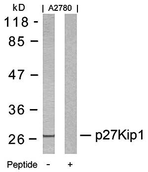 p27Kip1 (Ab0）Antibody