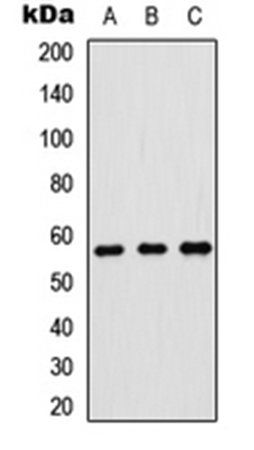 p57 Kip2 antibody | Biorbyt