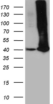 PDCL3 antibody