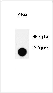 PDX1 (phospho-Thr11) antibody