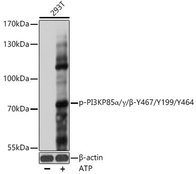 PI3KP85alpha/gamma/beta (Phospho-Y467/Y199/Y464) antibody
