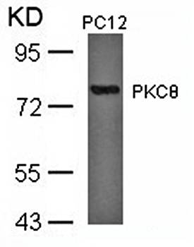 PKCθ (Ab-676) Antibody