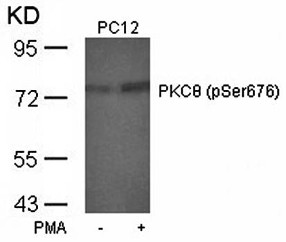 PKCθ (Phospho-Ser676) Antibody