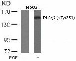 PLCγ2 (Phospho-Tyr753) Antibody