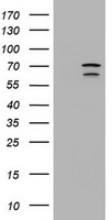 PPAR alpha (PPARA) antibody