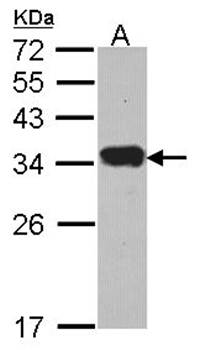 Protease Inhibitor 15 antibody