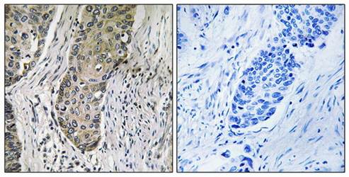 QSK antibody