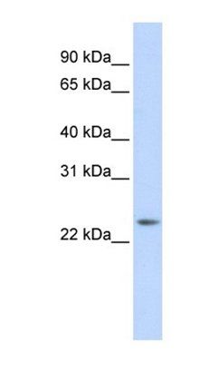 RAB8A antibody