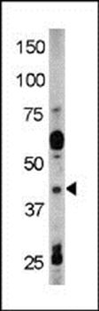 RAD9 (phospho-Tyr28) antibody