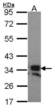 RANKL (CD254) antibody