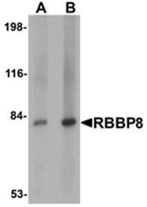 RBBP8 Antibody