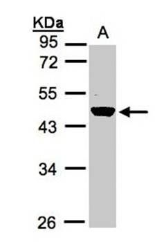 Renin in preproprotein antibody