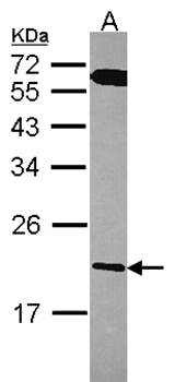 RGS10 antibody