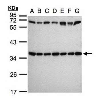 ribosomal protein S3a antibody
