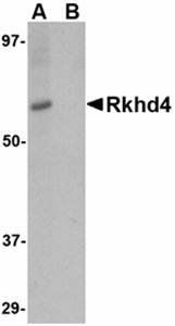 Rkhd4 Antibody