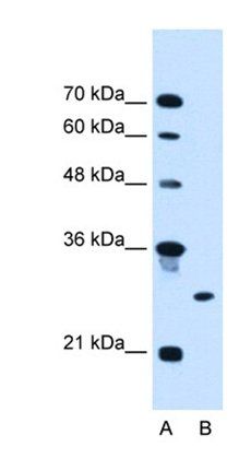 RNF39 antibody