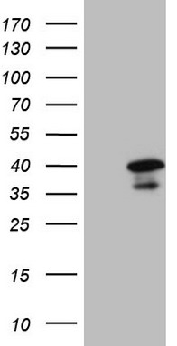 ROS1 antibody