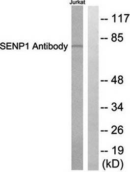 SENP1 antibody