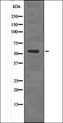 Smad1/5/9 (Phospho-Ser463+Ser465) antibody
