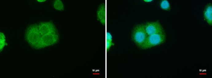 steroidogenic acute regulatory protein Antibody