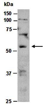 STEAP3 antibody