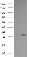 STING (TMEM173) antibody