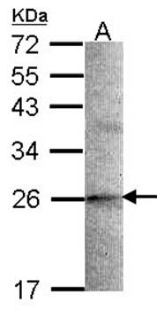 STMN2 antibody