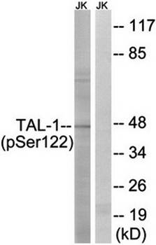 TAL-1 (phospho-Ser122) antibody