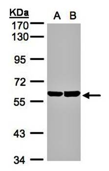 cell cycle progression 2 protein isoform 2 antibody