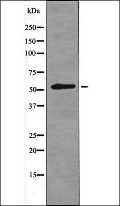 TGF beta Receptor I (Phospho-Ser165) antibody