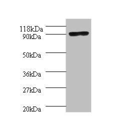 Thermus aquaticus DNA polymerase I, thermostable antibody