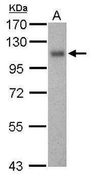 Thrombomodulin(CD141) antibody