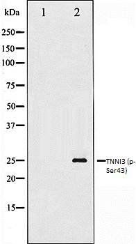 TNNI3 (phospho-Ser43) antibody