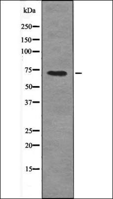 TORC2 (Phospho-Ser171) antibody