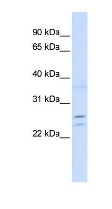 TPD52 antibody