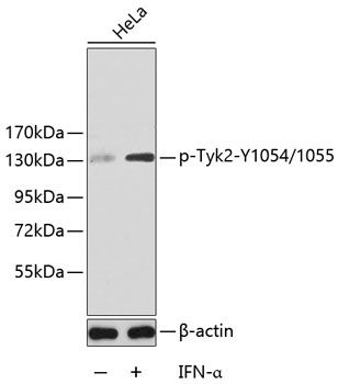 Tyk2 (Phospho-Y1054/1055) antibody