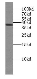 U2AF35 antibody