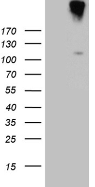 UBE2D4 antibody