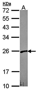 VBP1 antibody