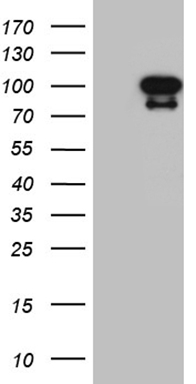 Vitamin D Binding protein (GC) antibody