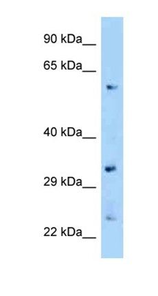 Zfp664 antibody