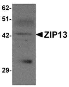 ZIP13 Antibody
