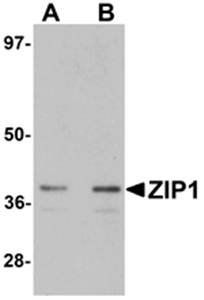 ZIP1 Antibody