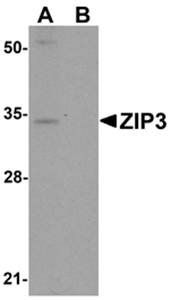 ZIP3 Antibody